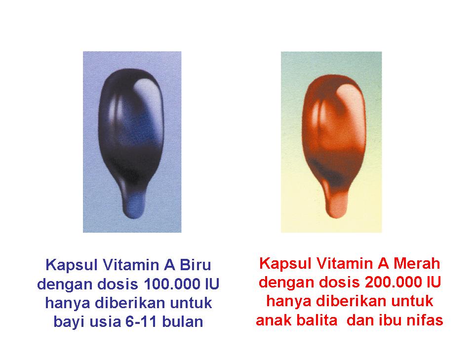 Pemberian Vitamin A pada Balita Di Polewali Mandar 